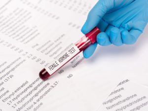 gloved doctor's had holding a hormone test sample to illustrate treating menopausal symptoms
