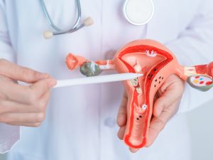 Doctor holding model of reproductive organs to illustrate hormone therapy after hysterectomy