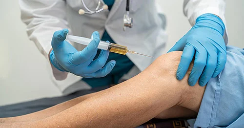 prp-injection-platelet-rich-plasma-knee-500x262