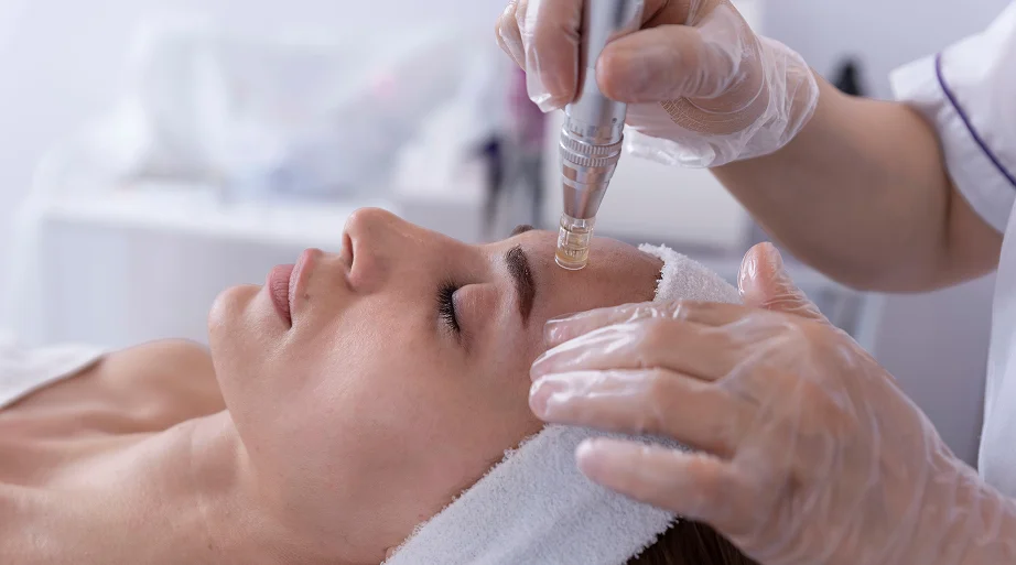 Reveal Your Best Skin with Professional Microneedling